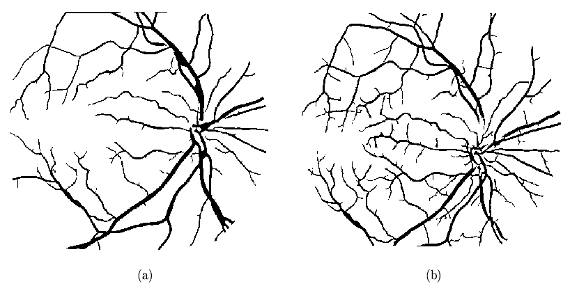 \begin{figure}\par\begin{picture}(450,200)
\par\put(-60,-110){\special{psfile=bw...
...
\put(345,-5){(b)}
\par % ponrejilla\{450\}\{220\}
\end{picture}\par\end{figure}
